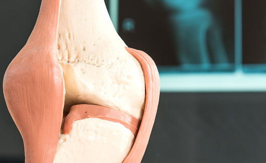 Knorpelzelltransplantation